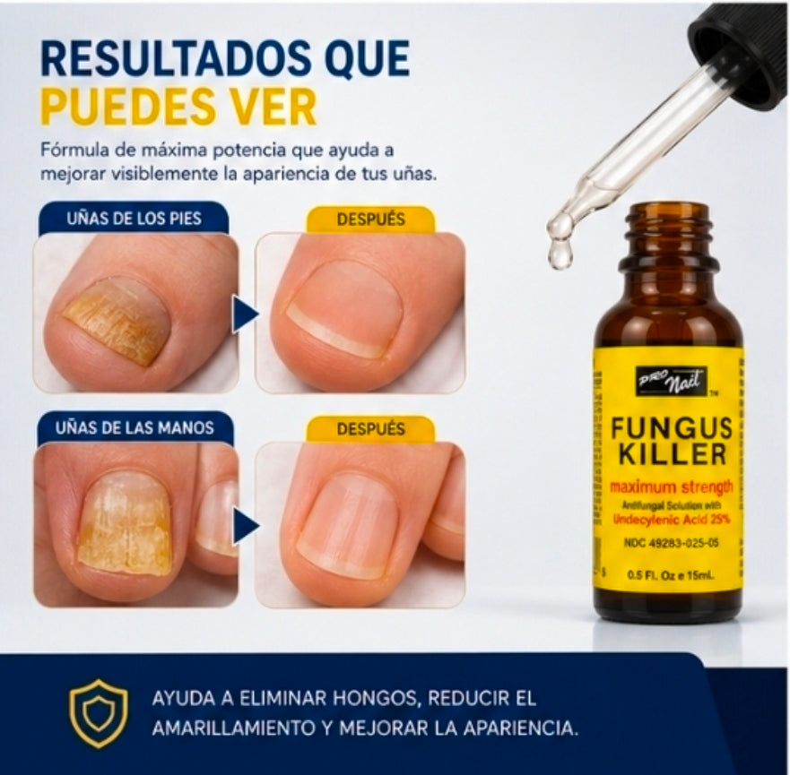 Fungus Killer Pro Nail – Tratamiento Antifúngico Máxima Potencia para Uñas y Pies | 15ml
